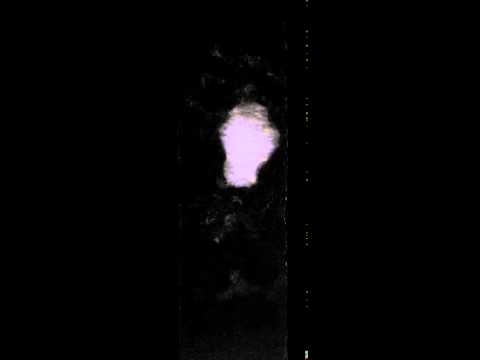X-ray diffraction contrast tomography - 2